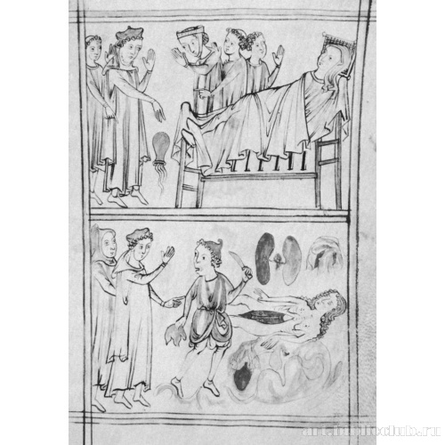 Визит врача к женщине; Вскрытие