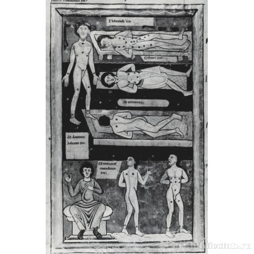 Точки для прижигания