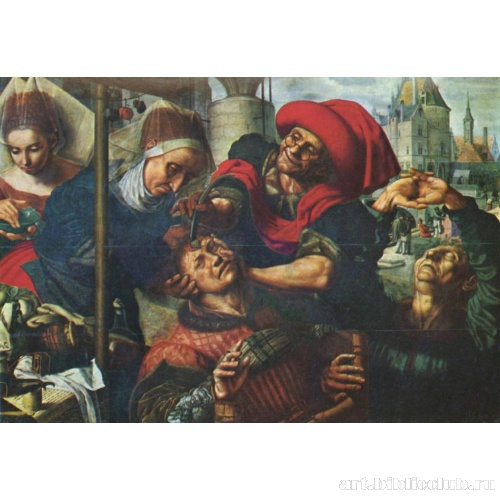 Трепанация черепа