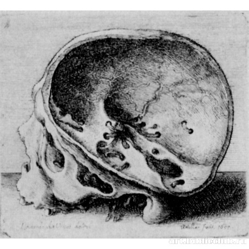 Распиленный человеческий череп