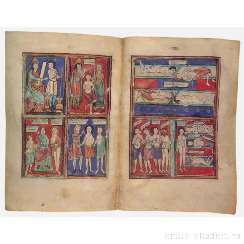 Медицинские миниатюры с указаниями точек прижигания